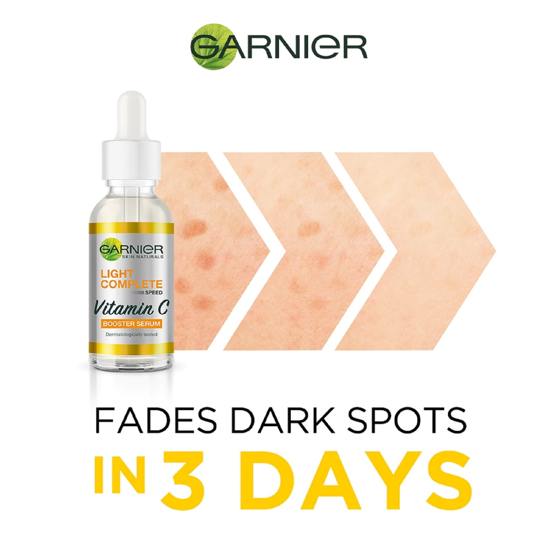 Garnier, Light Complete Vitamin C Serum (For Dark Spot) 30ml